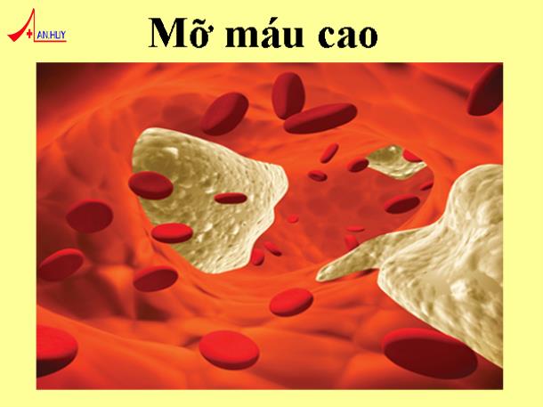 Mỡ máu cao ( Rối loạn lipid máu) là gì? – Nguyên nhân và hậu quả